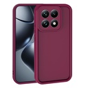 Xiaomi 15T Uyumlu Kılıf Kamera Korumalı Zore Ananas Kapak
