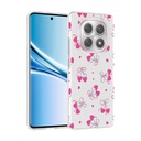 Xiaomi Redmi Note 14 Pro 4G Uyumlu Kılıf Kamera Korumalı Desenli Zore Klip Kapak