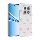 Xiaomi Redmi Note 15 4G Uyumlu Kılıf Kamera Korumalı Desenli Zore Klip Kapak