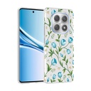 Xiaomi Redmi Note 15 4G Uyumlu Kılıf Kamera Korumalı Desenli Zore Klip Kapak