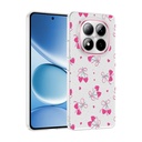 Xiaomi Redmi Note 15 Pro 4G Uyumlu Kılıf Kamera Korumalı Desenli Zore Klip Kapak