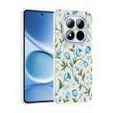 Xiaomi Redmi Note 15 Pro 4G Uyumlu Kılıf Kamera Korumalı Desenli Zore Klip Kapak