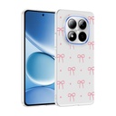 Xiaomi Redmi Note 15 Pro Uyumlu Kılıf Kamera Korumalı Desenli Zore Klip Kapak