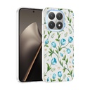 Xiaomi 15T Uyumlu Kılıf Kamera Korumalı Desenli Zore Klip Kapak