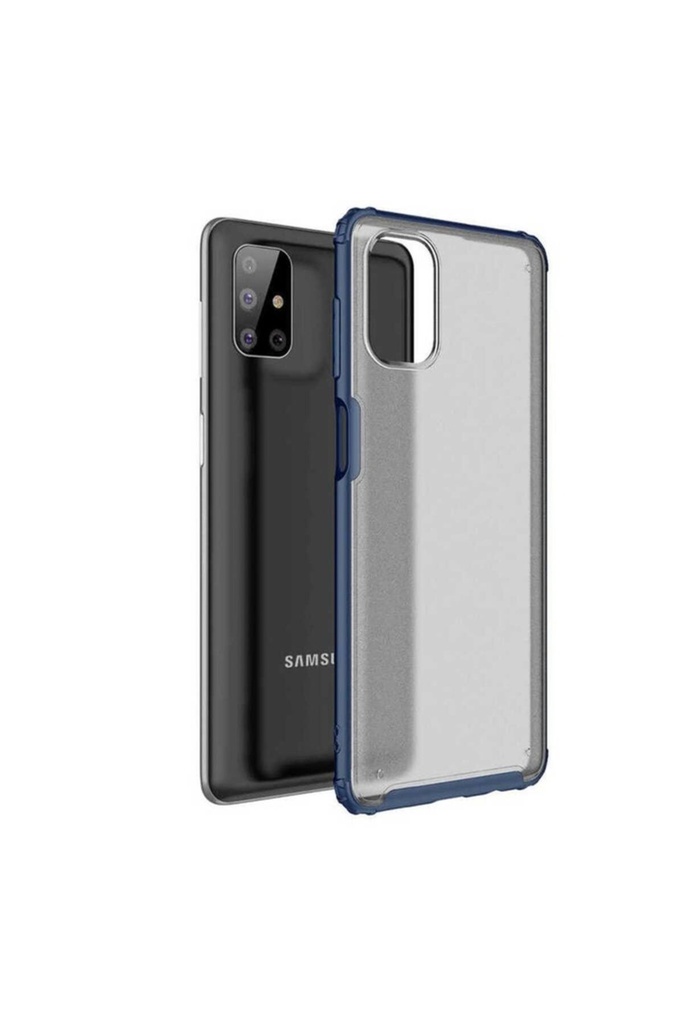 Samsung Galaxy M51 Uyumlu Kılıf Zore Volks Kapak