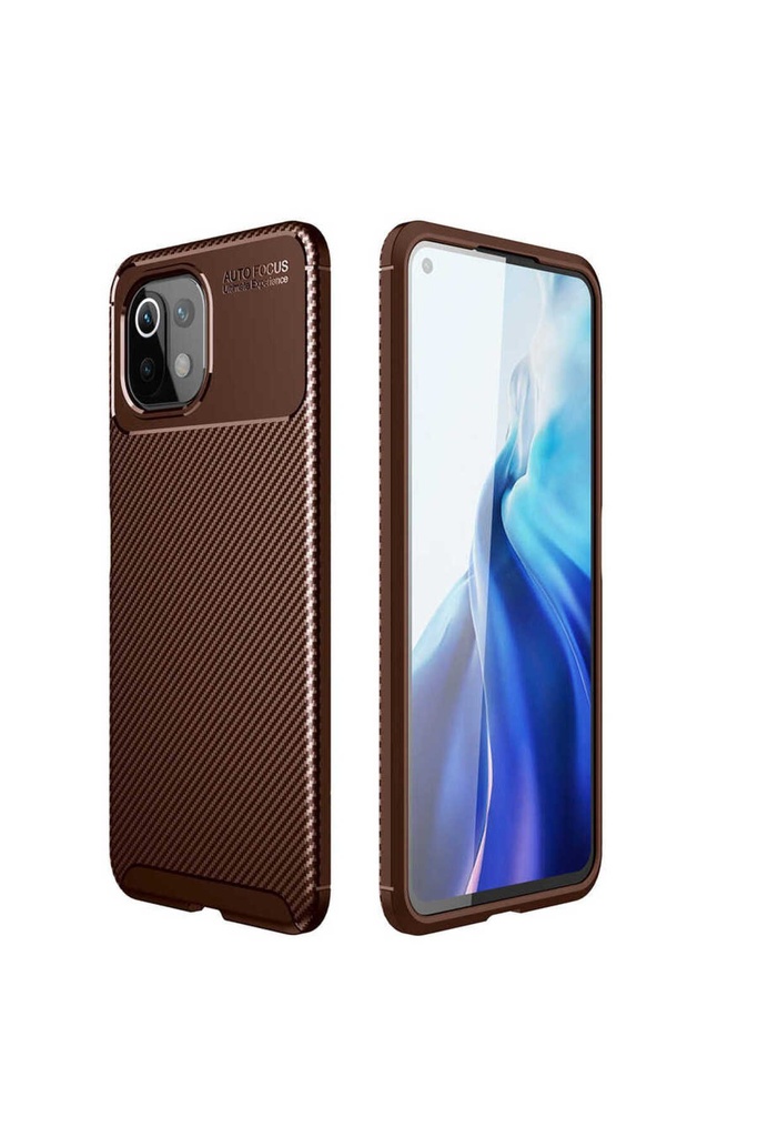 Xiaomi Mi 11 Lite Uyumlu Kılıf Zore Negro Silikon Kapak