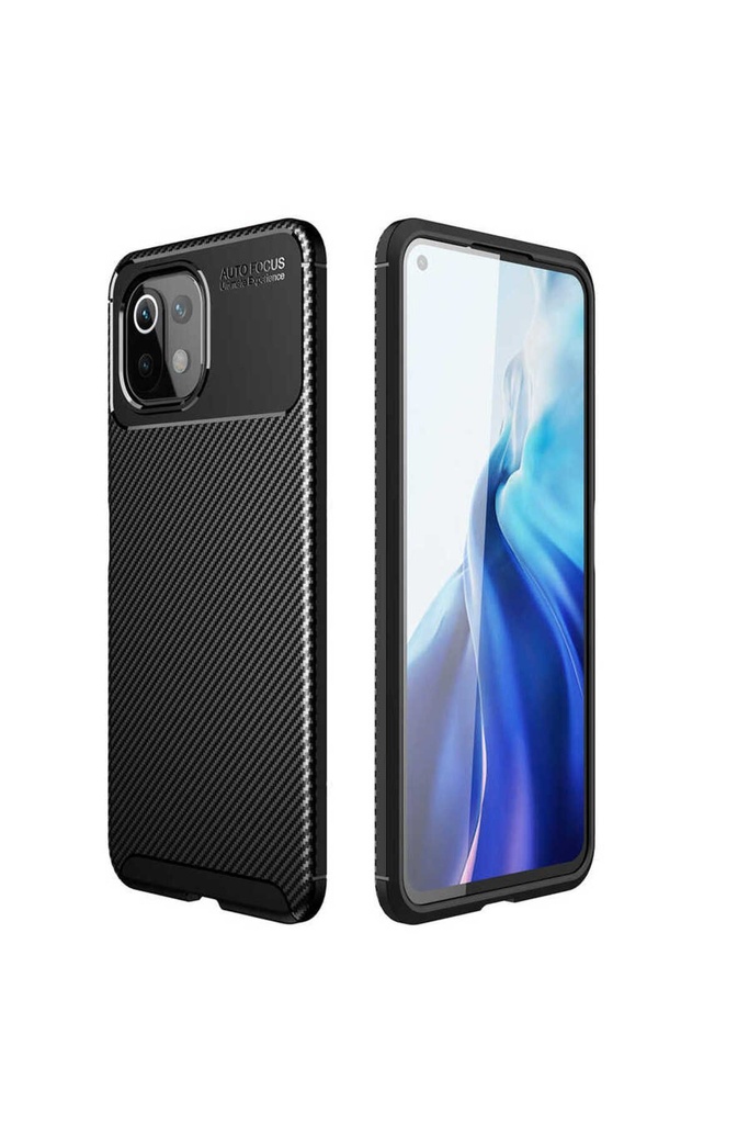 [RNZ-TA52664] Xiaomi Mi 11 Lite Uyumlu Kılıf Zore Negro Silikon Kapak (Siyah)