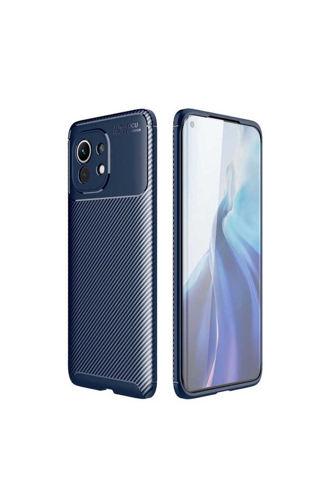 Xiaomi Mi 11 Uyumlu Kılıf Zore Negro Silikon Kapak