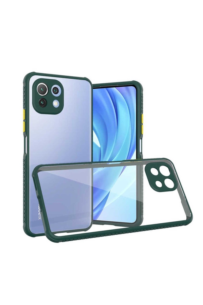 Xiaomi Mi 11 Lite Uyumlu Kılıf ​​Zore Kaff Kapak