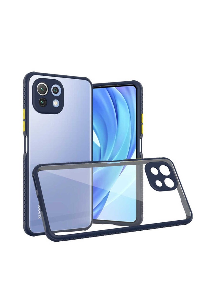 Xiaomi Mi 11 Lite Uyumlu Kılıf ​​Zore Kaff Kapak