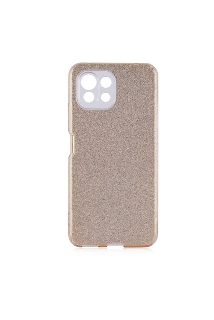 Xiaomi Mi 11 Lite Uyumlu Kılıf Zore Shining Silikon