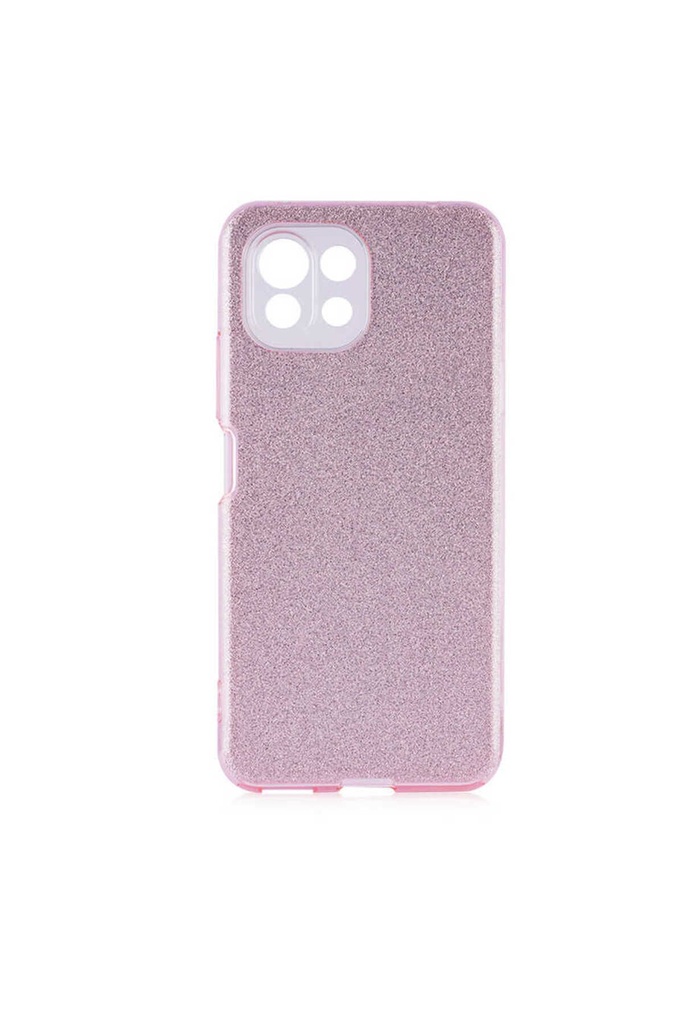Xiaomi Mi 11 Lite Uyumlu Kılıf Zore Shining Silikon