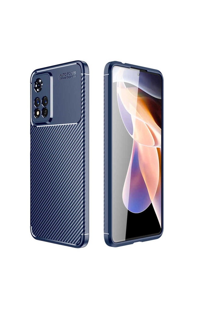 Xiaomi Redmi Note 11 Pro Plus 5G Uyumlu Kılıf Zore Negro Silikon Kapak