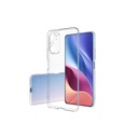 Xiaomi Redmi Note 10 Uyumlu Kılıf Zore Süper Silikon Kapak