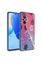 Huawei Nova 9 SE Uyumlu Kılıf Kamera Korumalı Desenli Sert Silikon Zore Epoksi Kapak