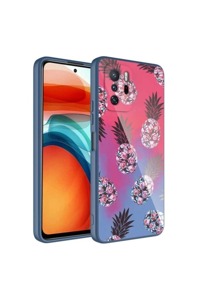 Xiaomi Redmi Note 10 Pro Uyumlu Kılıf Kamera Korumalı Desenli Sert Silikon Zore Epoksi Kapak