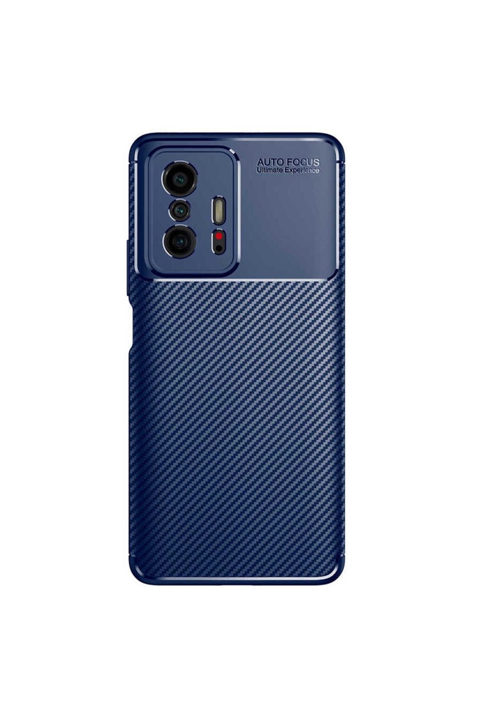 Xiaomi Mi 11T 5G Uyumlu Kılıf Zore Negro Silikon Kapak