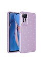 Xiaomi Redmi Note 12 Pro 4G Uyumlu Kılıf Kamera Korumalı Simli Lüks Zore Koton Kapak