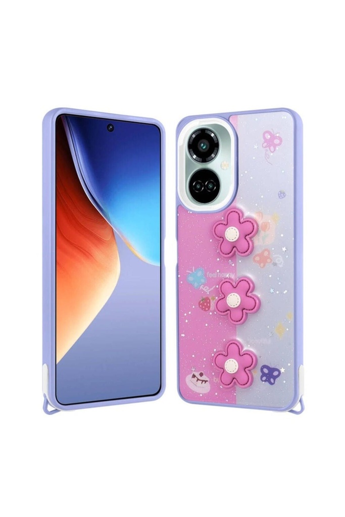 Tecno Camon 19 Pro Uyumlu Kılıf Parlayan Simli Kabartma Figürlü Zore Cevze Kapak
