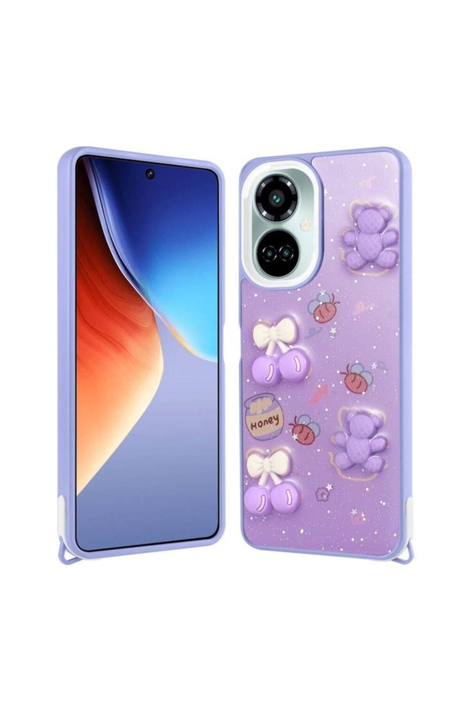 Tecno Camon 19 Pro Uyumlu Kılıf Parlayan Simli Kabartma Figürlü Zore Cevze Kapak