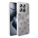 Xiaomi 14T Pro Uyumlu Kılıf Kamera Korumalı Figürlü Zore Ponti Silikon Kapak