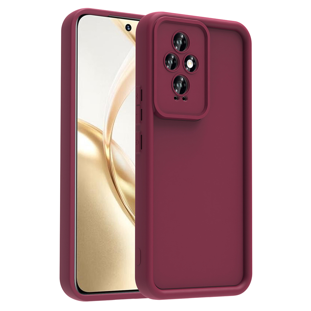 Honor 200 Uyumlu Kılıf Kamera Korumalı Zore Ananas Kapak