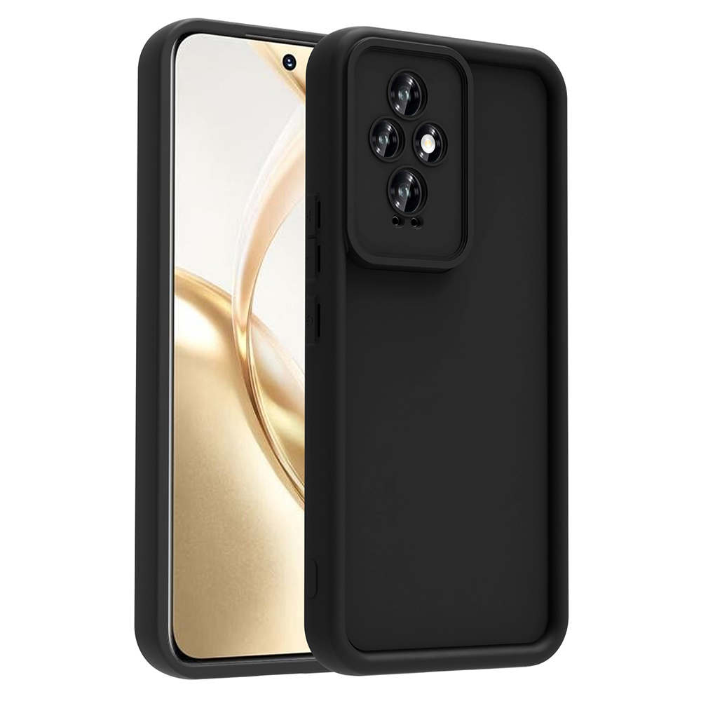 Honor 200 Uyumlu Kılıf Kamera Korumalı Zore Ananas Kapak
