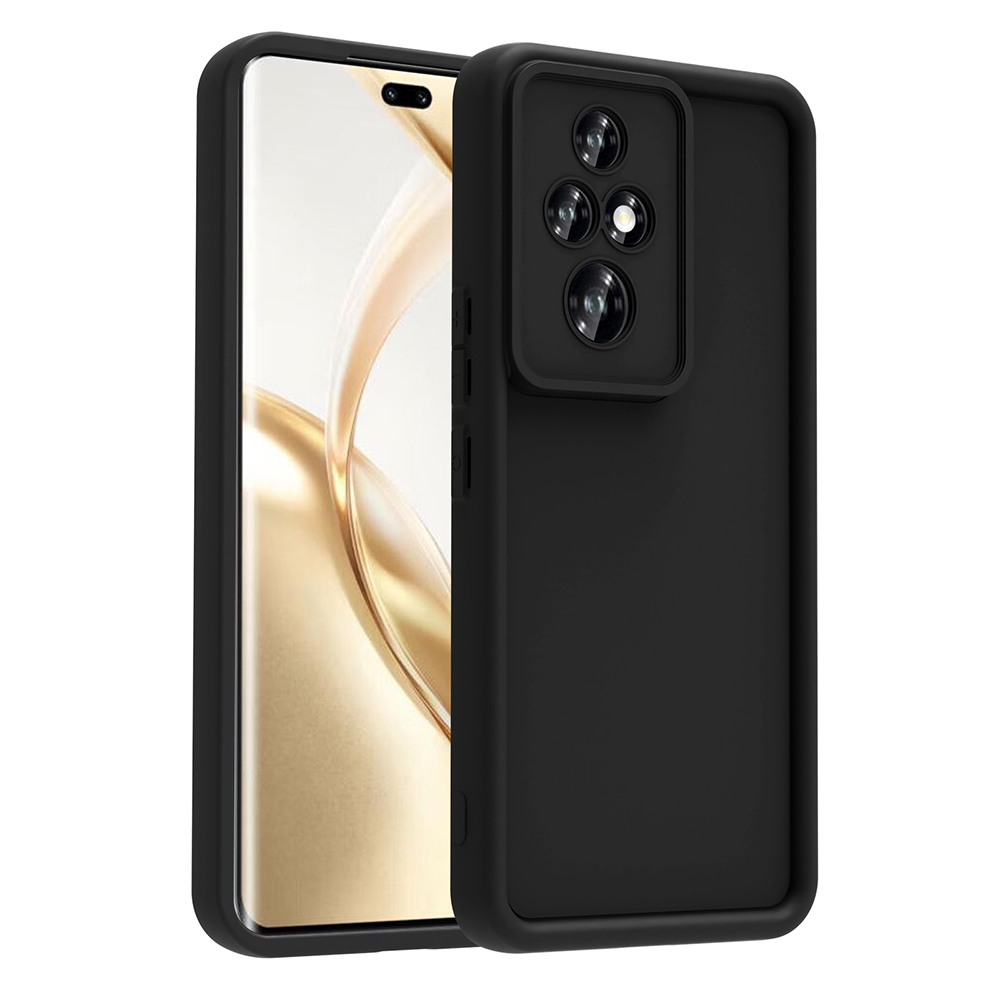 [RNZ-TA117761] Honor 200 Pro Uyumlu Kılıf Kamera Korumalı Zore Ananas Kapak (Siyah)