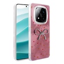 Xiaomi Redmi Note 14 Pro Plus Uyumlu Kılıf Kamera Korumalı Figürlü Zore Ponti Silikon Kapak